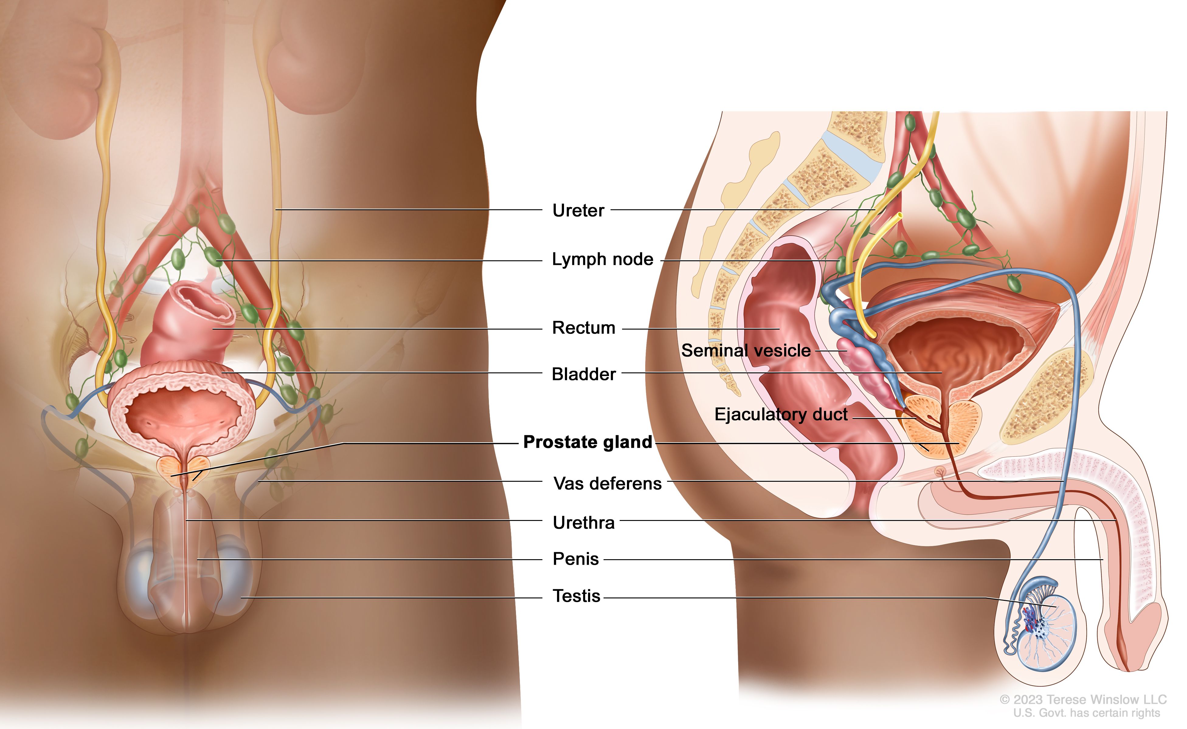 Prostate Cancer Treatment PDQ NCI