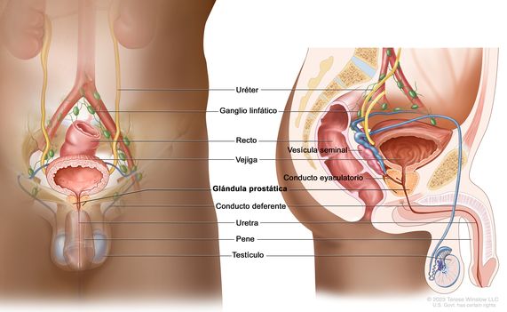 cancer de prostata ubicacion)