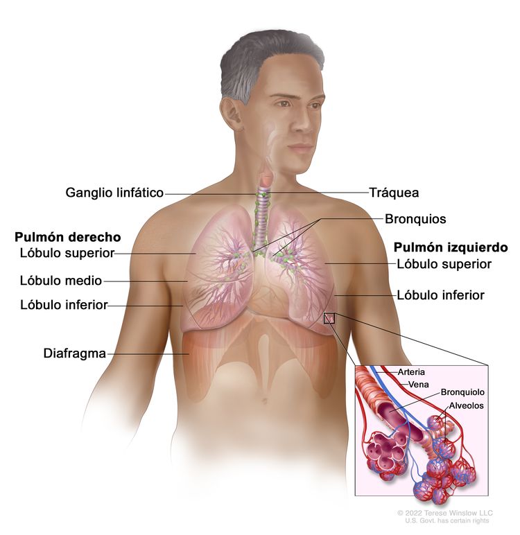 Anatomía respiratoria; en la imagen se observan el pulmón derecho con los lóbulos superiores, medios e inferiores; el pulmón izquierdo con los lóbulos superiores e inferiores; y la tráquea, los bronquios, los ganglios linfáticos y el diafragma. En el recuadro se muestran los bronquiolos, los alvéolos, una arteria y una vena.