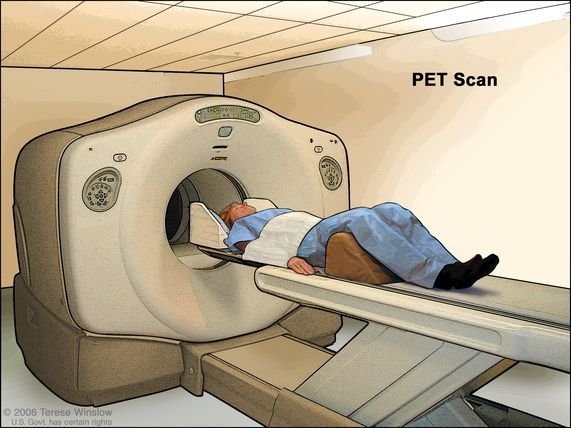 der ovre nevø Fakultet Definition of PET scan - NCI Dictionary of Cancer Terms - NCI