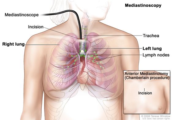 Anatomy of the Chest – Female Anterior – Artery Studios – Medical