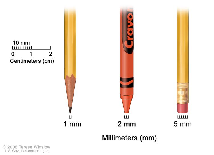 Millimeters; drawing shows millimeters (mm) using everyday objects. A sharp pencil point shows 1 mm, a new crayon point shows 2 mm, and a new pencil-top eraser shows 5 mm.