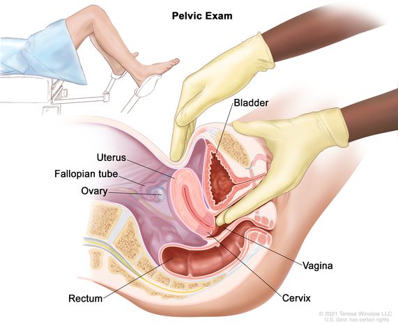 Diagnosing for appendicitis: pelvic exam - Healthsoothe