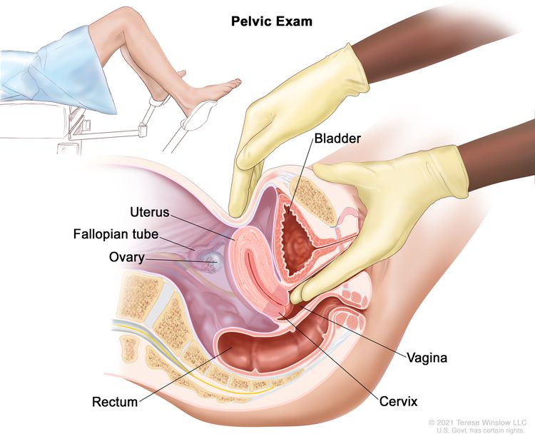 Vaginal Cancer Treatment Pdq Patient Version National Cancer Institute