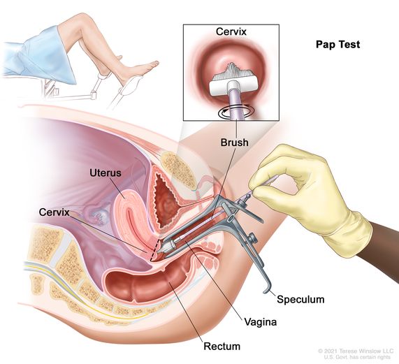 Abnormal Pap Smear Means