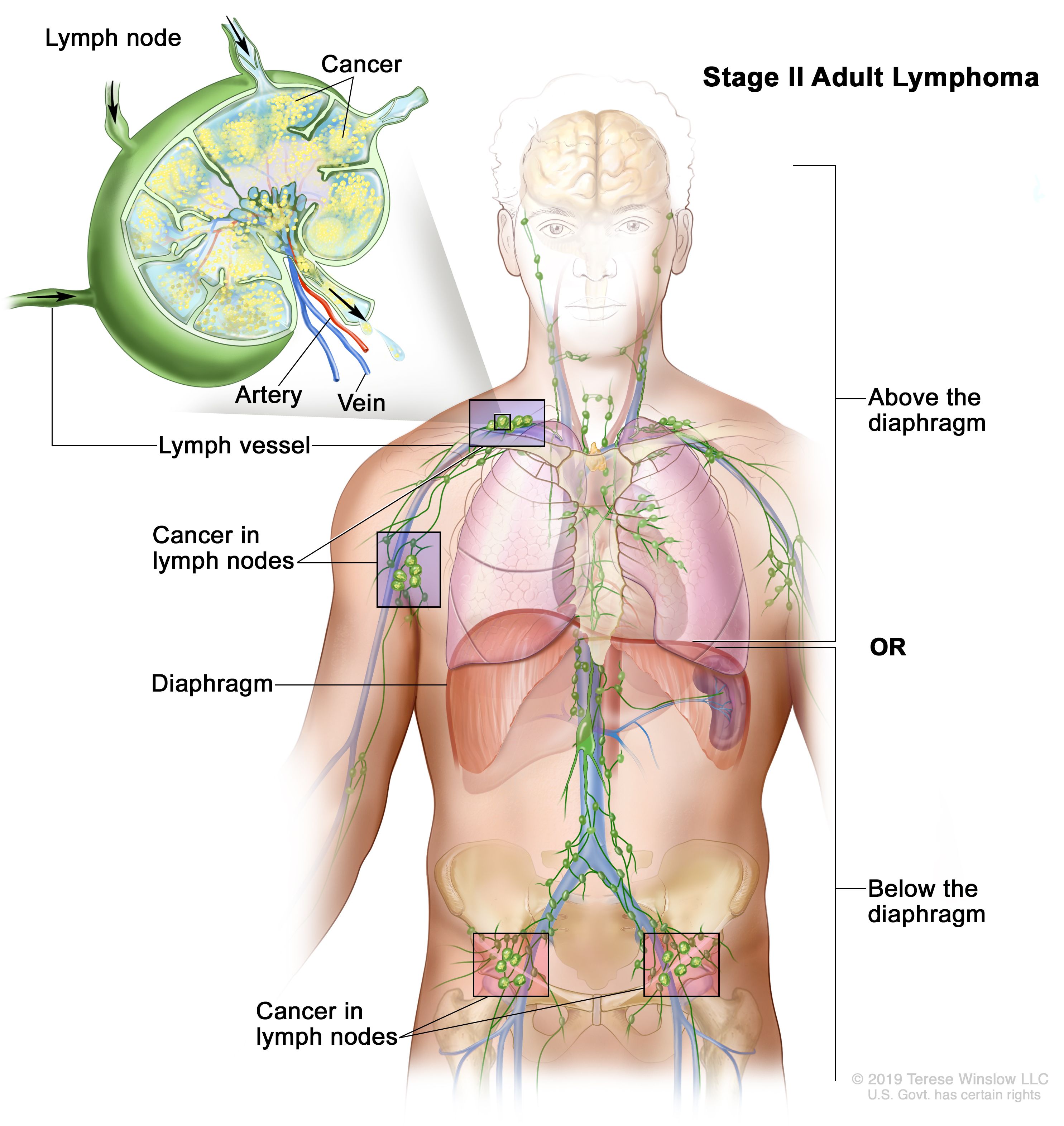Lymphatic Drainage of the Head and Neck - TeachMeAnatomy