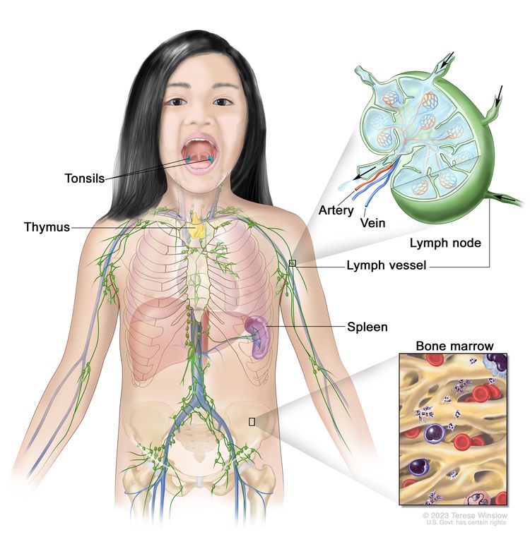 Lymph system; drawing shows the tonsils, thymus, spleen, bone marrow, lymph vessels, and lymph nodes. One inset shows the inside structure of a lymph node and the attached lymph vessels with arrows showing how the lymph (clear, watery fluid) moves into and out of the lymph node. Another inset shows a close up of bone marrow with blood cells.