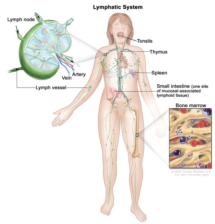 lymphedema-nci