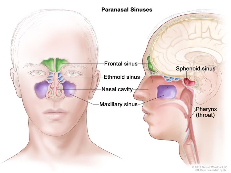 Anatomy of the paranasal sinuses; drawing shows front and side views of the frontal sinus, ethmoid sinus, maxillary sinus, and sphenoid sinus. The nasal cavity and pharynx (throat) are also shown.