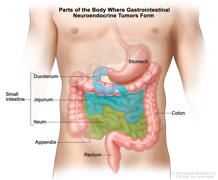 Parts of the body where gastrointestinal carcinoid tumors form; drawing of the gastrointestinal tract showing the stomach, small intestine (including the duodenum, jejunum, and ileum), appendix, colon, and rectum.