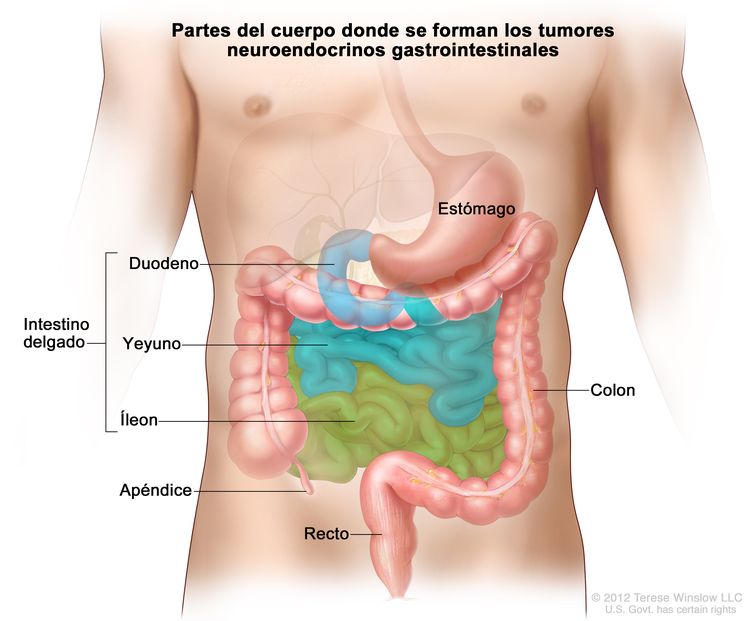 Partes del cuerpo donde se forman los tumores carcinoides gastrointestinales. En la imagen del tubo gastrointestinal se muestran el estómago, el intestino delgado (incluso el duodeno, el yeyuno y el íleon), el apéndice y el recto.