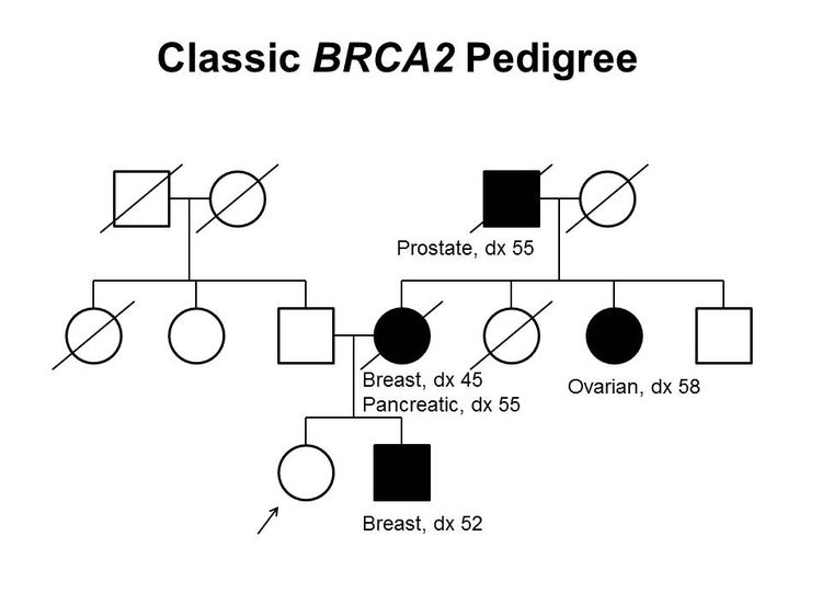 Pedigree showing some of the classic features of a family with a deleterious BRCA2 mutation across three generations, including transmission occurring through maternal and paternal lineages. The unaffected female proband is shown as having an affected brother (breast cancer diagnosed at age 52 y), mother (breast cancer diagnosed at age 45 y and pancreatic cancer diagnosed at age 55 y), maternal aunt (ovarian cancer diagnosed at age 58 y), and maternal grandfather (prostate cancer diagnosed at age 55 y).