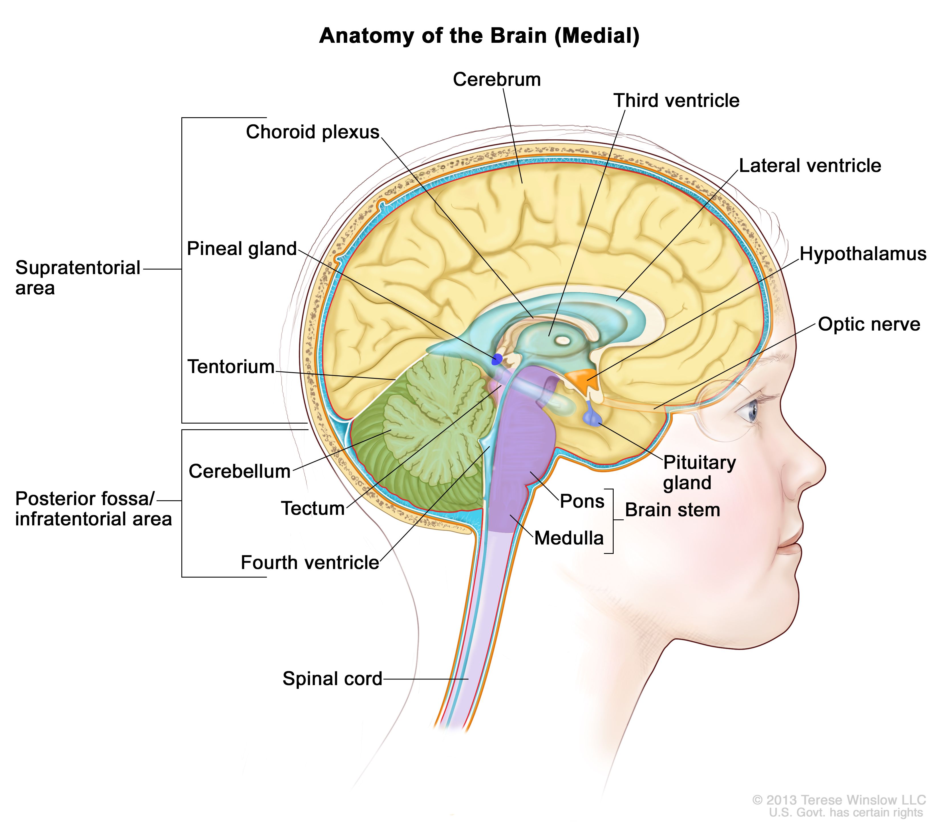 Drawing of the inside of the brain showing the supratentorial area (the upper part of the brain) and the posterior fossa/infratentorial area (the lower back part of the brain). The supratentorial area contains the cerebrum, lateral ventricle, third ventricle, choroid plexus, hypothalamus, pineal gland, pituitary gland, and optic nerve. The posterior fossa/infratentorial area contains the cerebellum, tectum, fourth ventricle, and brain stem (pons and medulla). The tentorium and spinal cord are also shown.