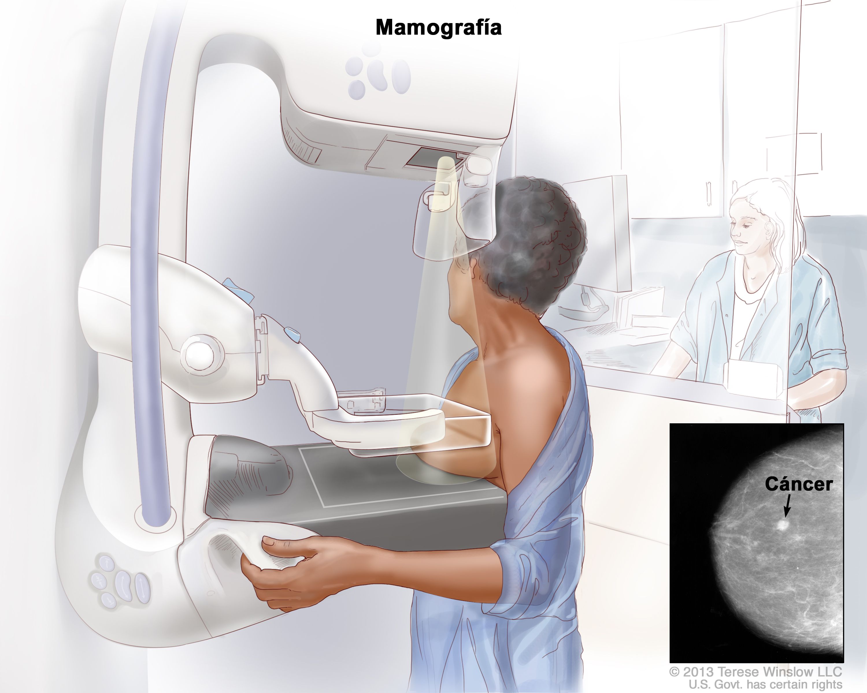 как делают маммографию груди у женщин фото 32