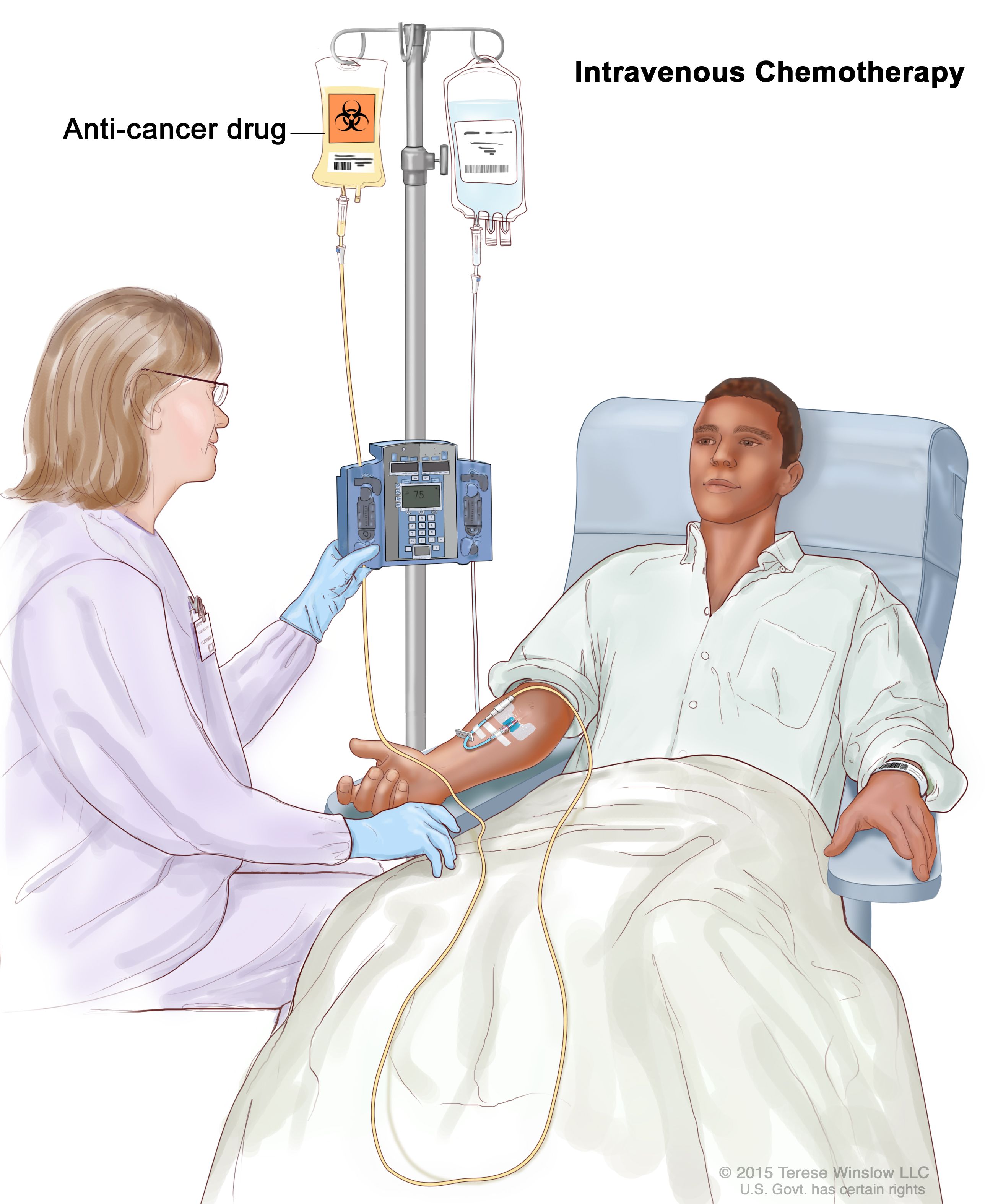 Getting Iv Or Injectable Chemotherapy