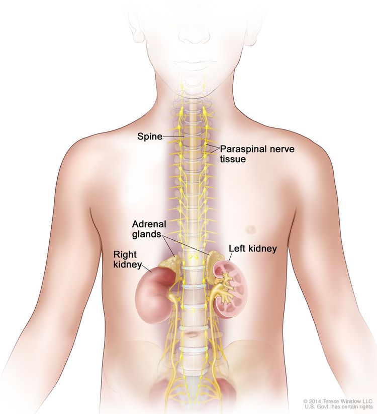 Drawing shows parts of the body where neuroblastoma may be found, including the paraspinal nerve tissue and the adrenal glands. Also shown are the spine and right and left kidney.