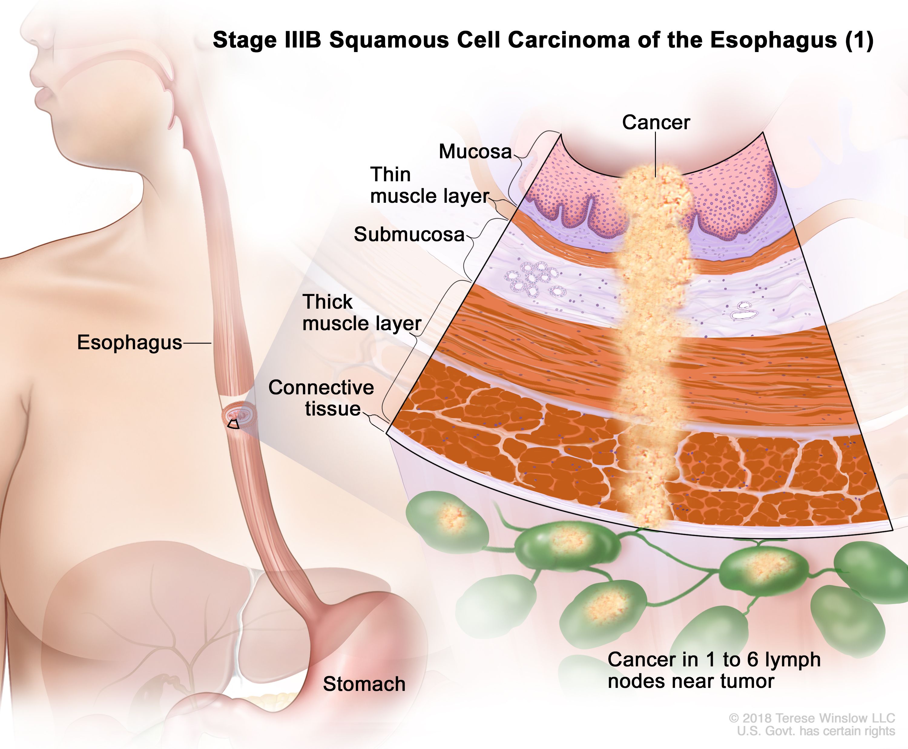 Description of muscle disease – specific diseases (Section 3B