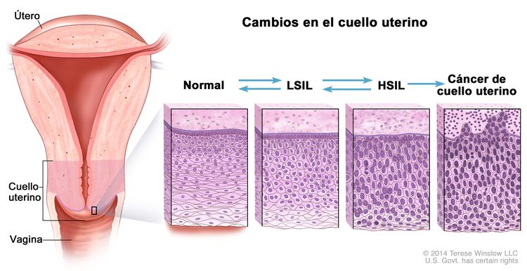 what-is-pap-smear-results-bilder-zum-nachmalen