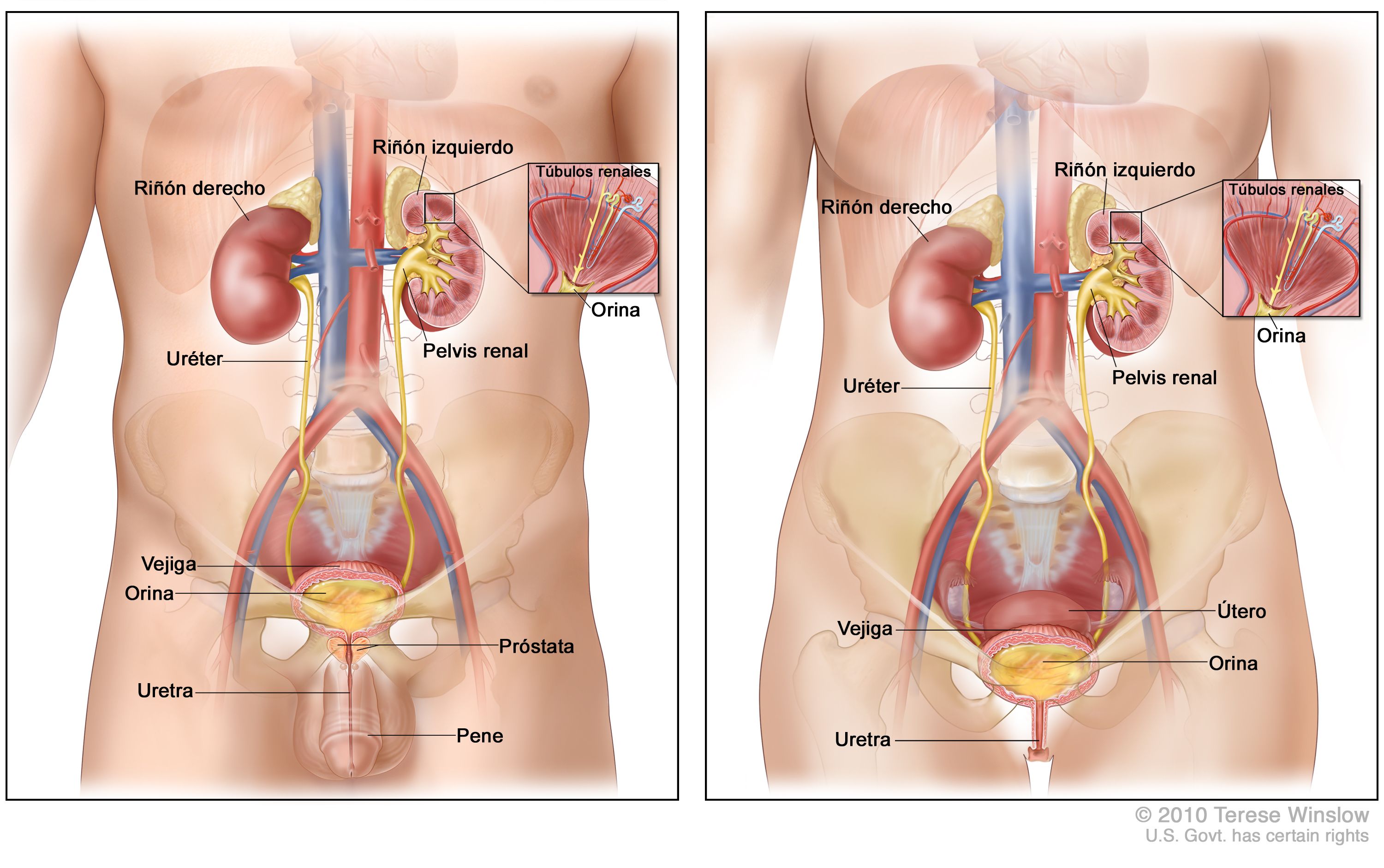 cancer uretra femenina sintomas