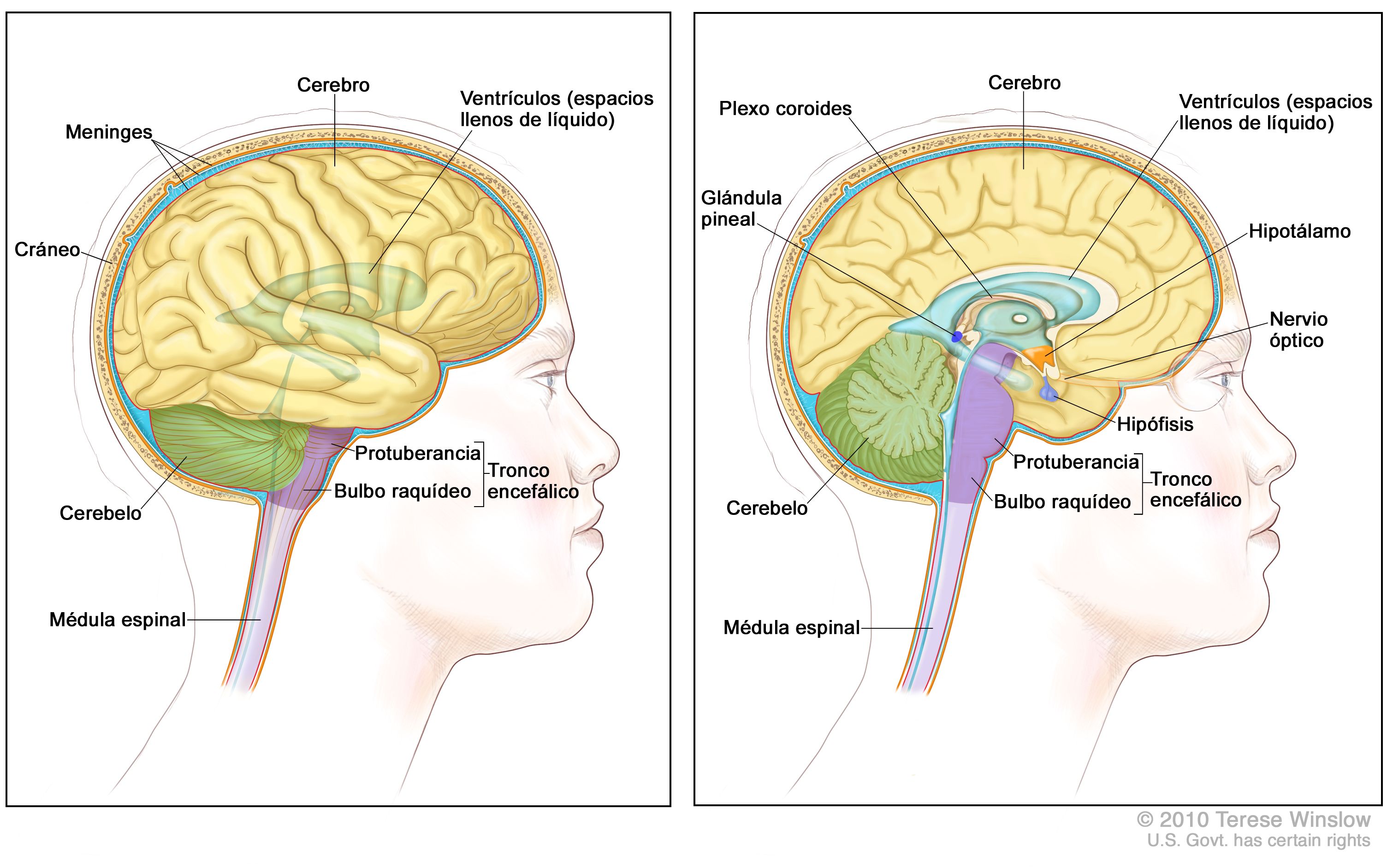 Tratamiento de los tumores del sistema nervioso central en adultos  (PDQ®)–Versión para pacientes - NCI