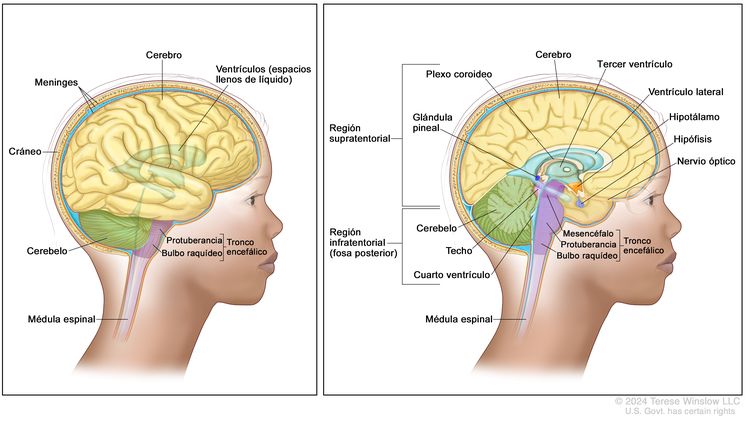 Anatomía del encéfalo. Dibujo dividido en dos paneles. En el panel derecho se observa el interior de la cabeza de un niño donde se señalan las dos regiones del encéfalo: supratentorial en la porción superior e infratentorial (fosa posterior) en la porción inferior y posterior. En la región supratentorial se señala el cerebro, un ventrículo lateral, el tercer ventrículo con el líquido cefalorraquídeo en azul, el plexo coroideo, la glándula pineal, el hipotálamo, la hipófisis y un nervio óptico. En la región infratentorial (fosa posterior), se señala el cerebelo, el techo del mesencéfalo, el cuarto ventrículo, la tienda del cerebelo, la médula espinal y las tres partes del tronco encefálico: mesencéfalo, protuberancia y bulbo raquídeo. En el panel izquierdo se observa el interior de la cabeza de un niño donde se señalan el cerebro, los ventrículos (espacios llenos de líquido), las meninges, el cráneo, el cerebelo, la médula espinal y dos partes del tronco encefálico: protuberancia y bulbo raquídeo.