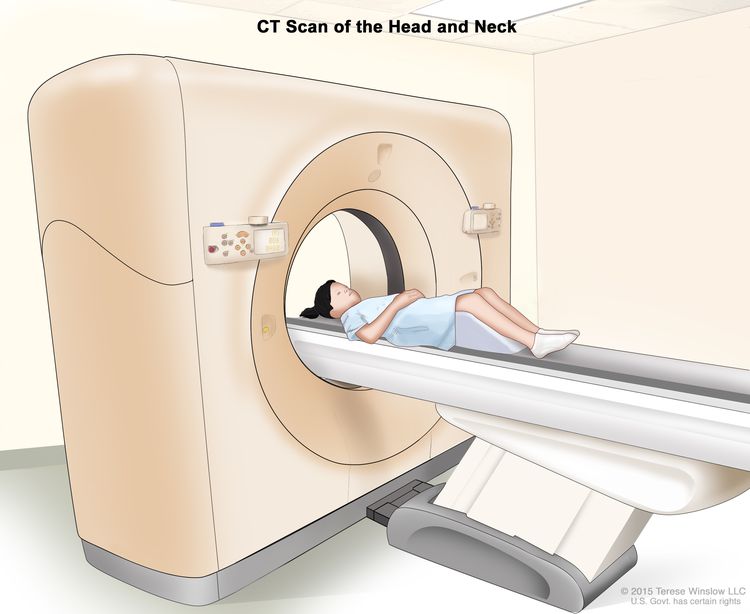 Computed tomography (CT) scan of the head and neck; drawing shows a child lying on a table that slides through the CT scanner, which takes a series of detailed x-ray pictures of the inside of the head and neck.