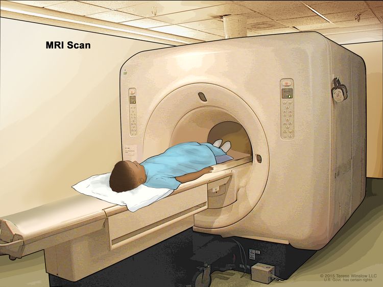 Magnetic resonance imaging (MRI) of the abdomen; drawing shows a child lying on a table that slides into the MRI scanner, which takes pictures of the inside of the body. The pad on the child’s abdomen helps make the pictures clearer.