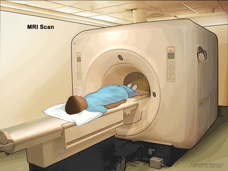 Soft Tissue Sarcoma Treatment - NCI