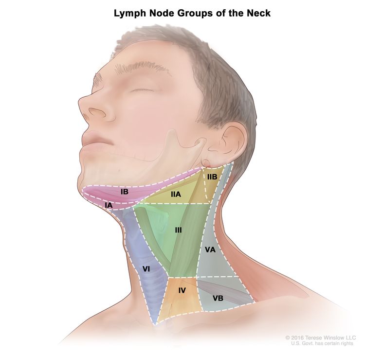 Lymph node groups of the neck; drawing shows six groups of lymph nodes in the neck: group IA and IB, group IIA and IIB, group III, group IV, group VA and VB, and group VI.