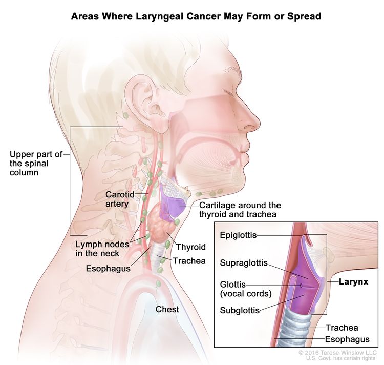 types of neck tumors