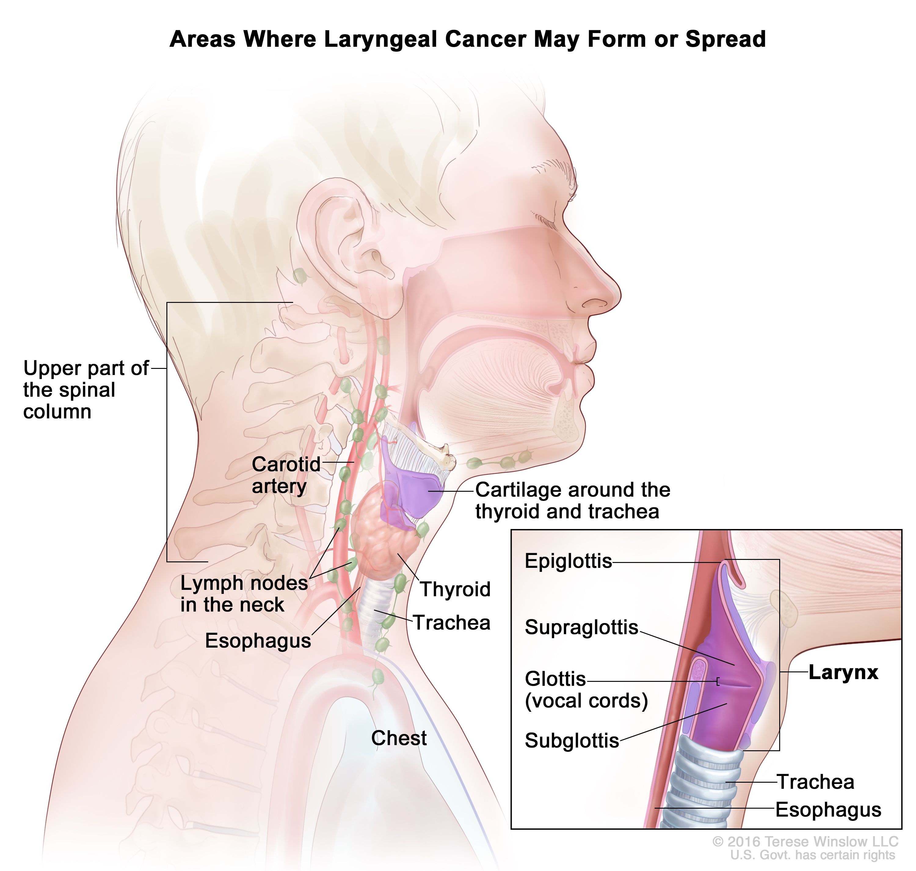 laryngeal cancer treatment)