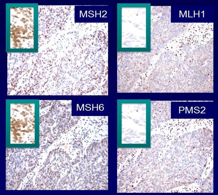 Genetics of Breast and Gynecologic Cancers (PDQ®) - PDQ Cancer