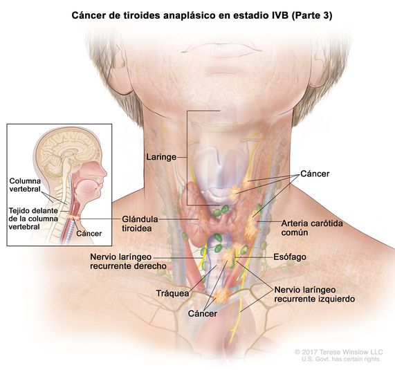 Definición de columna vertebral - Diccionario de cáncer del NCI - NCI