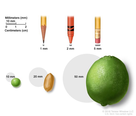 How Many Mm Is 6 1 2 Cm