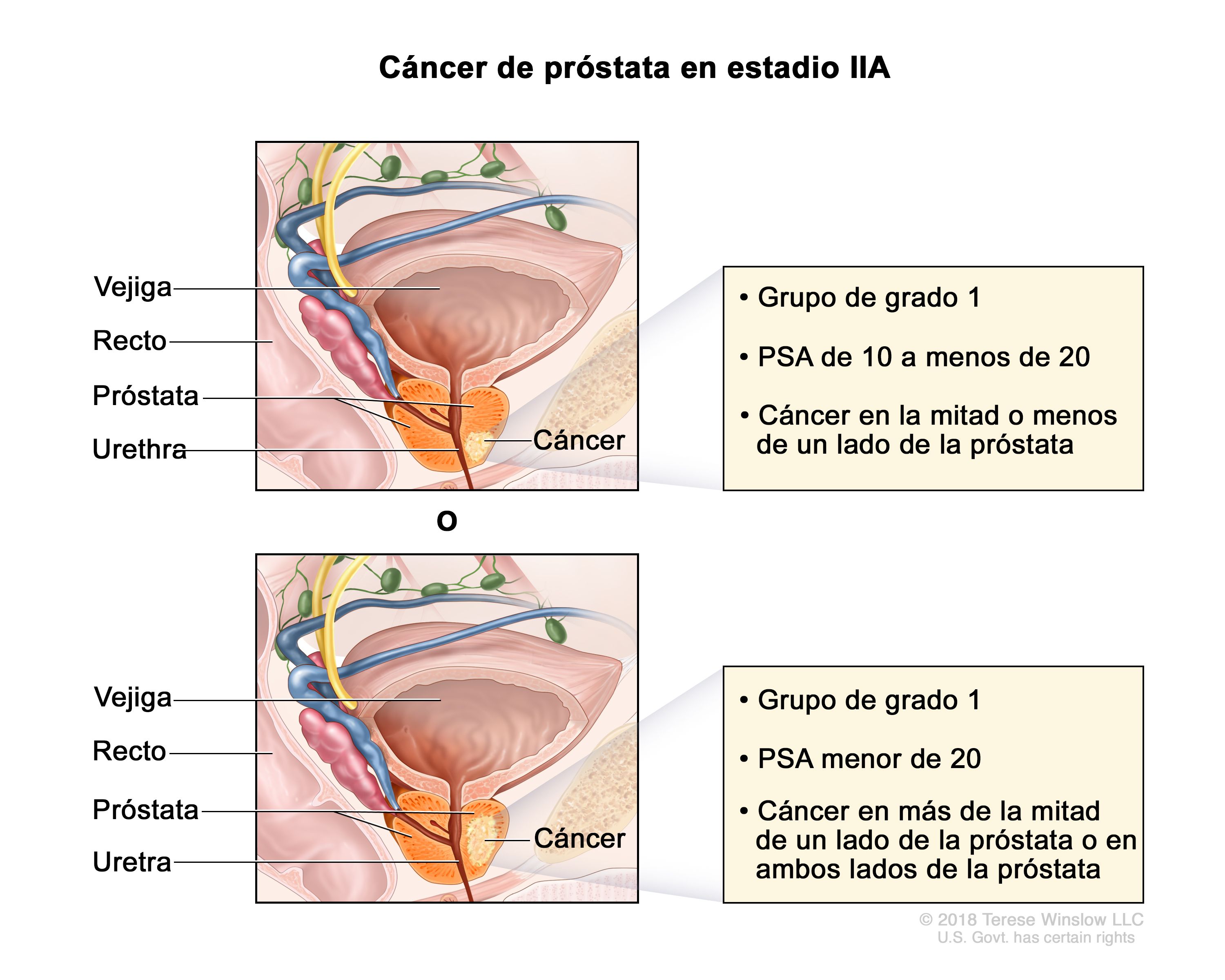 anatomia prostatica por ultrasonido