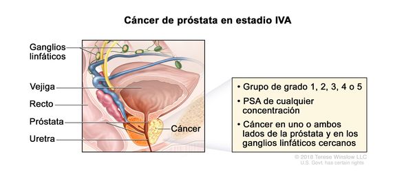 cancer de prostata pronostico)