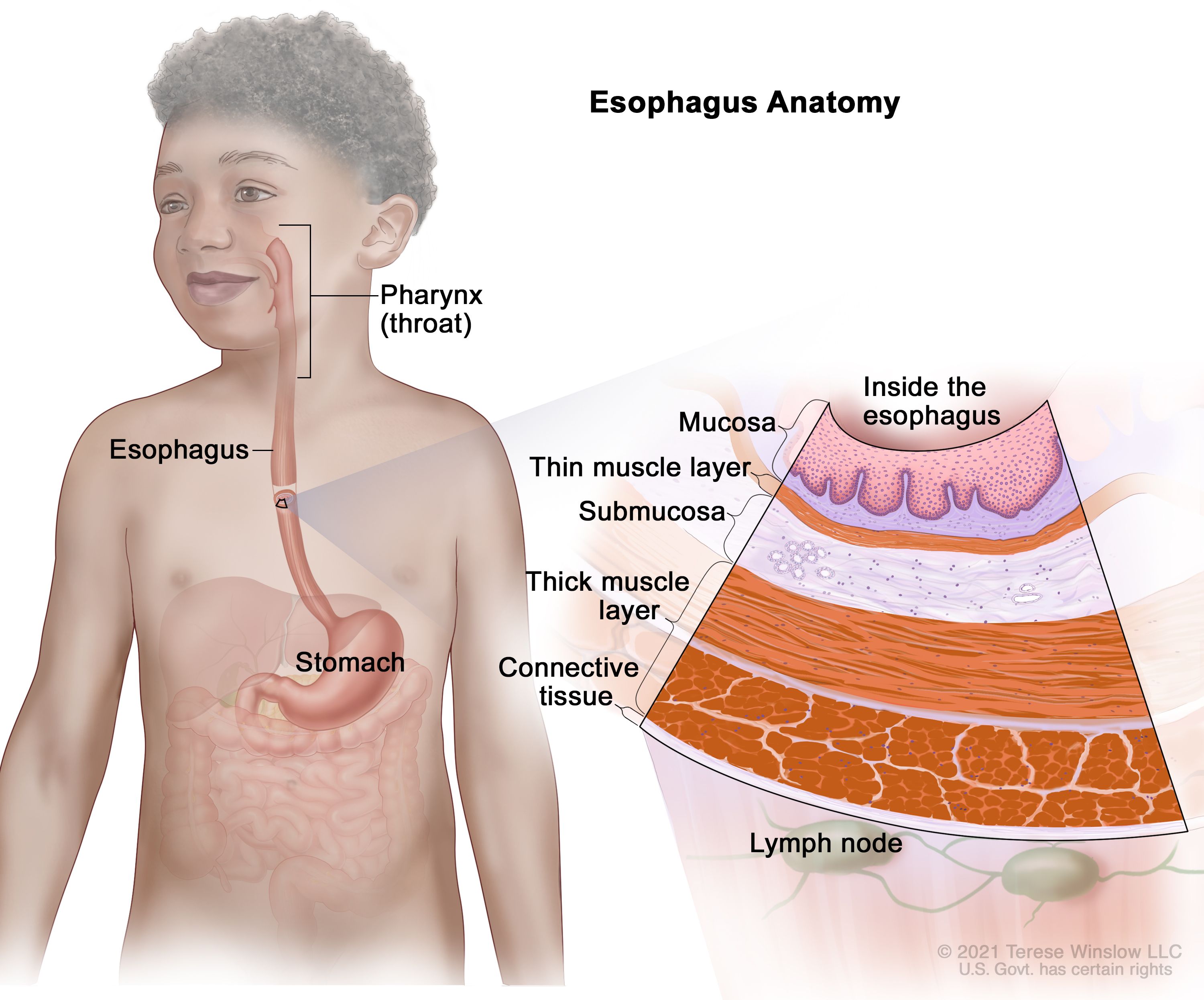 食道の解剖図：図は咽頭（喉）、食道、胃を示す。拡大図は、食道壁の粘膜層、薄い筋層、粘膜下層、厚い筋層、結合組織層を示している。さらにリンパ節も示している。