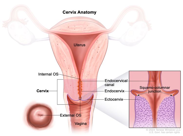 Anatomy of the cervix; drawing shows the internal OS, endocervical canal, endocervix, ectocervix, and external OS. A pullout shows the squamocolumnar junction (the area where the endocervix and ectocervix meet) and the cells that line the endocervix and ectocervix. The uterus and vagina are also shown.