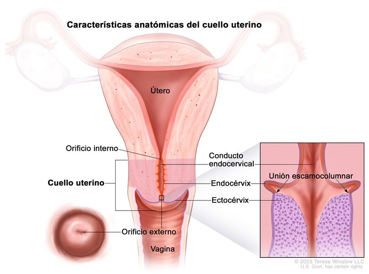 En el dibujo se observan las aracterísticas anatómicas del cuello uterino. Se muestran el orificio interno, el conducto endocervical, el endocérvix, el ectocérvix y el orificio externo. También se observan el útero y la vagina. Además, en un recuadro se muestra una vista de cerca de la unión escamocolumnar (área donde el endocérvix se une al ectocérvix) y las células que revisten el endocérvix y el ectocérvix.
