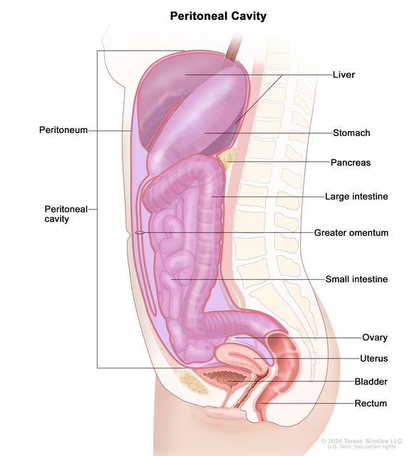 Drawing shows a cross section of the peritoneal cavity and the peritoneum. Also shown are the liver, stomach, pancreas, large intestine, greater omentum, small intestine, ovary, uterus, bladder, and rectum.